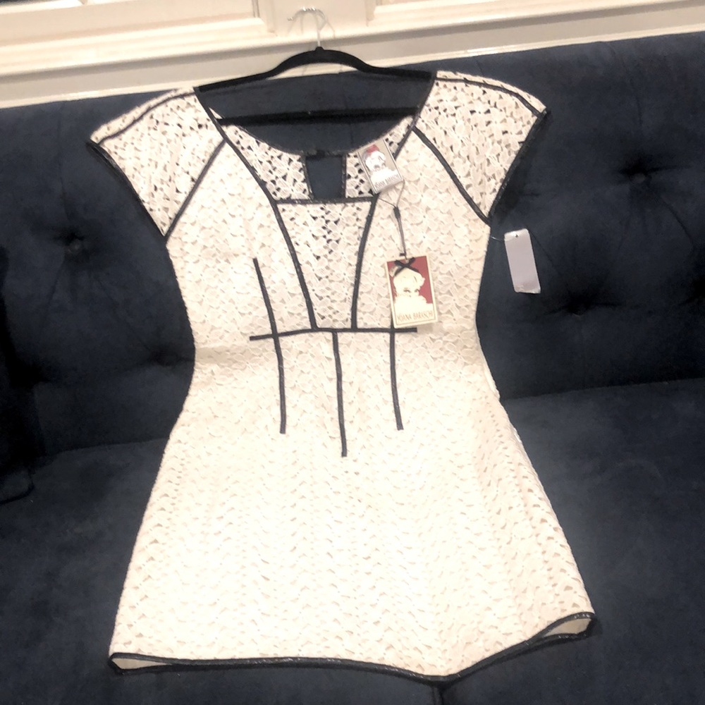 Lace mini dress!